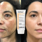 Nida Protector Solar Antimanchas SPF 50