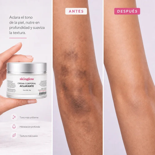 SkinGlow® Tratamiento Aclarante